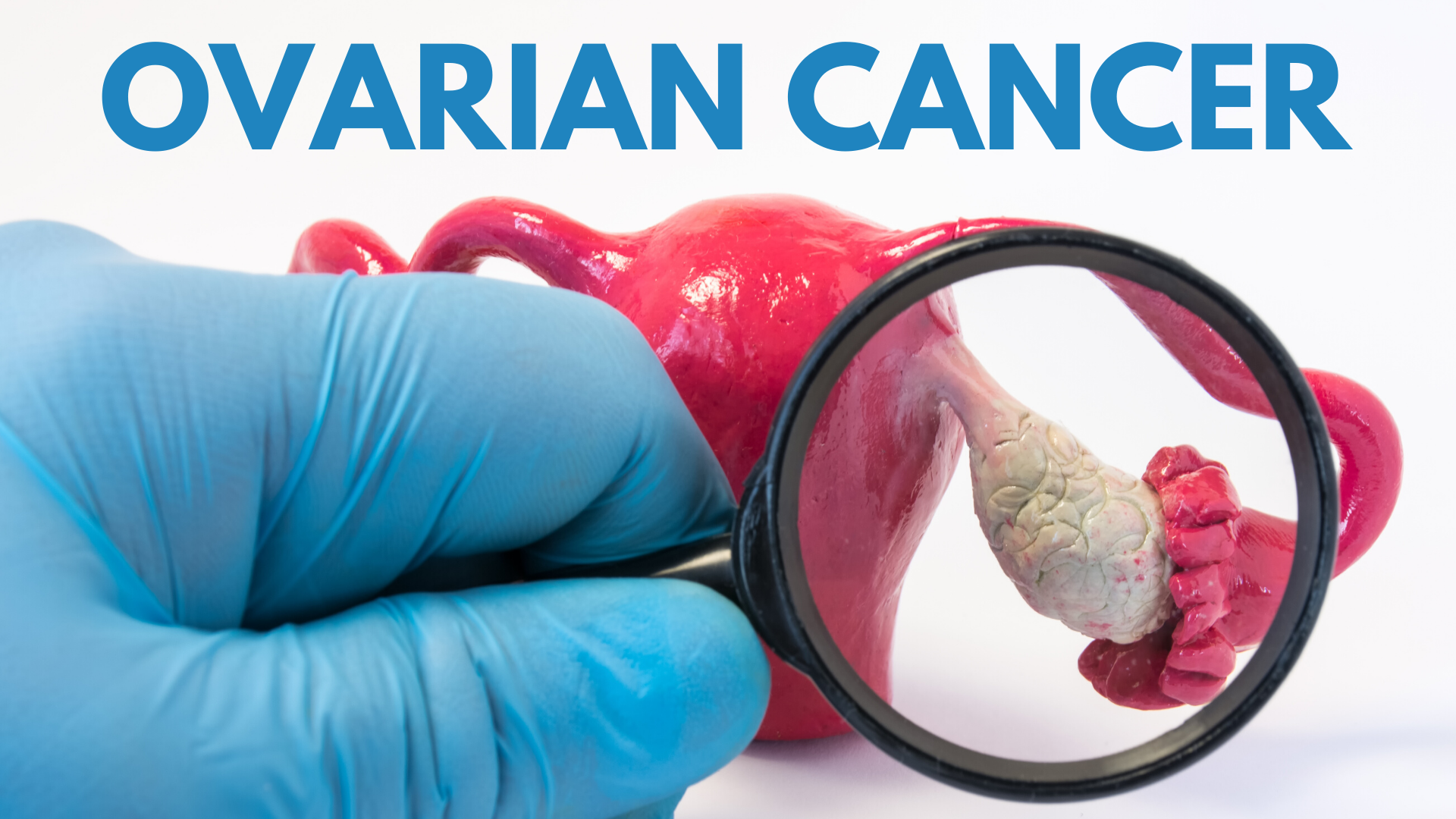 Can A Ct Scan Show If Ovarian Cancer Has Spread